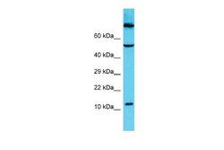 C9orf16 Rabbit anti-Human, Polyclonal, Novus Biologicals 0.1 mL | Buy Online | Novus Biologicals | Fisher Scientific
